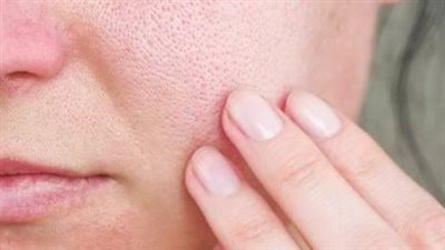 4 خطوات بسيطة لبشرة خالية من المسام الواسعة ونقية تمامًا