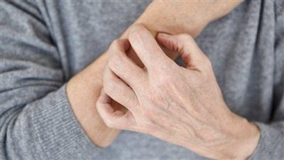 حكة الجلد.. إنذار مبكر لمشكلات الكبد الخطيرة اكتشف الأسباب