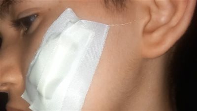 واقعة مؤسفة بالتعليم.. طالب يهاجم زميله بـ«كتر» داخل الفصل