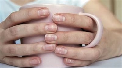 ألوان وخطوط الأظافر تكشف أسرارا مدهشة عن صحتك 