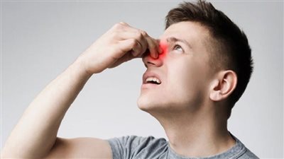أبرز أعراض ومضاعفات حساسية الجيوب الأنفية المزمنة