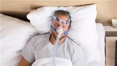 إزالة اللحمية قد تنقذك من مضاعفات انقطاع التنفس