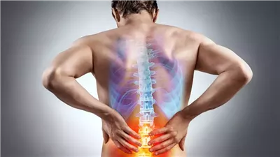 عرق النساء.. أسبابه وأعراضه وطرق العلاج الفعالة