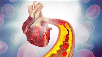 إنذار صامت: ارتفاع الكوليسترول يهدد القلب.. أبرز علامات الخطر