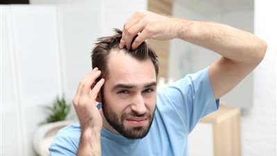 أسباب تساقط الشعر المبكر وطرق الوقاية منه